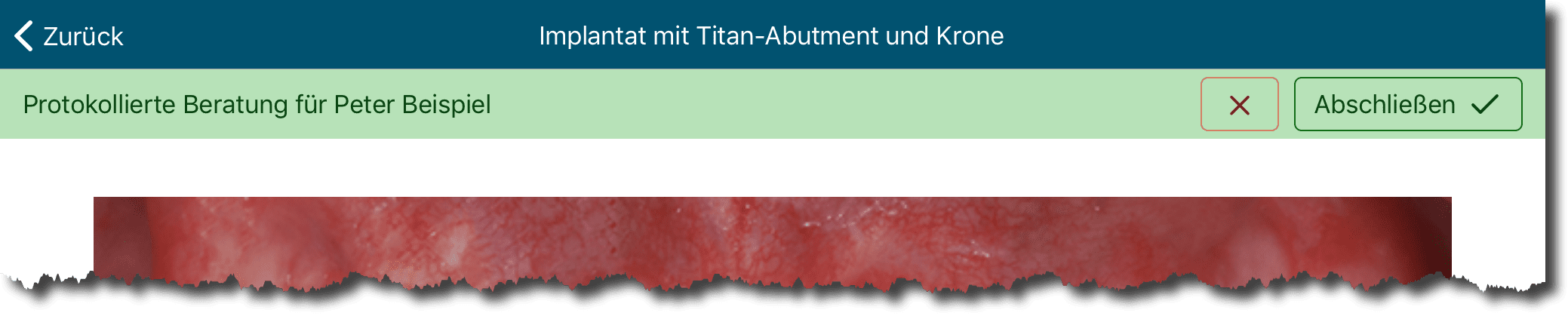 Athena Beispiel Beratungsprotokoll - abschließen