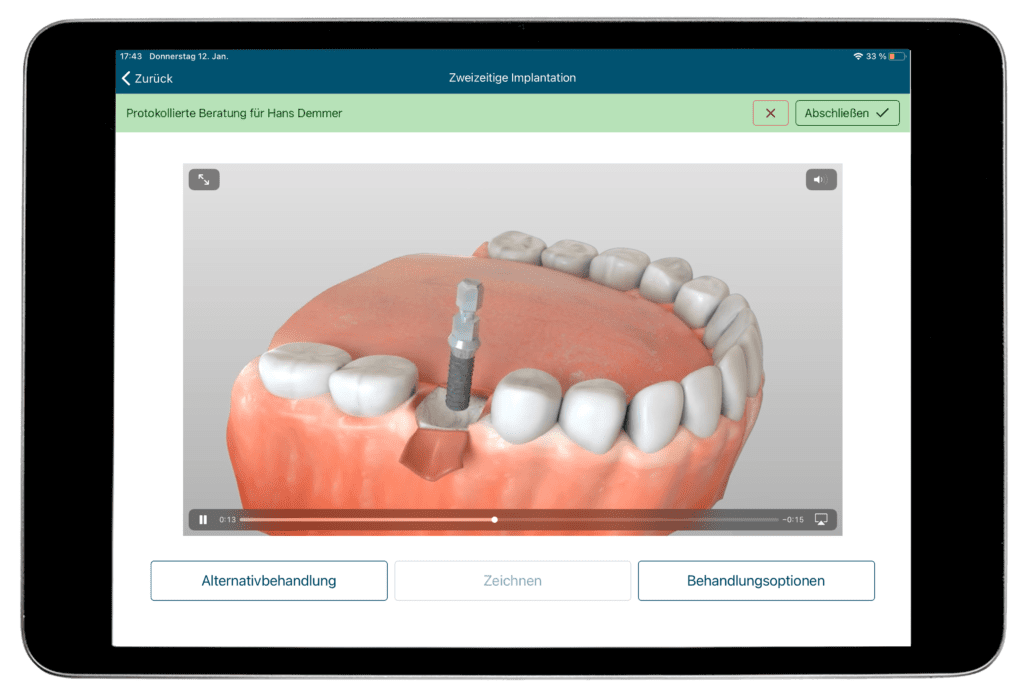 Patientenberatung mit Video. Implantation in der Athena-App. Digitale Anamnese und Aufklärung mit der Athena-App.