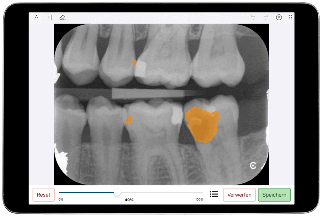 zahnmedizin ki röntgenbildanalyse. Digitale Anamnese und Aufklärung mit der Athena-App.