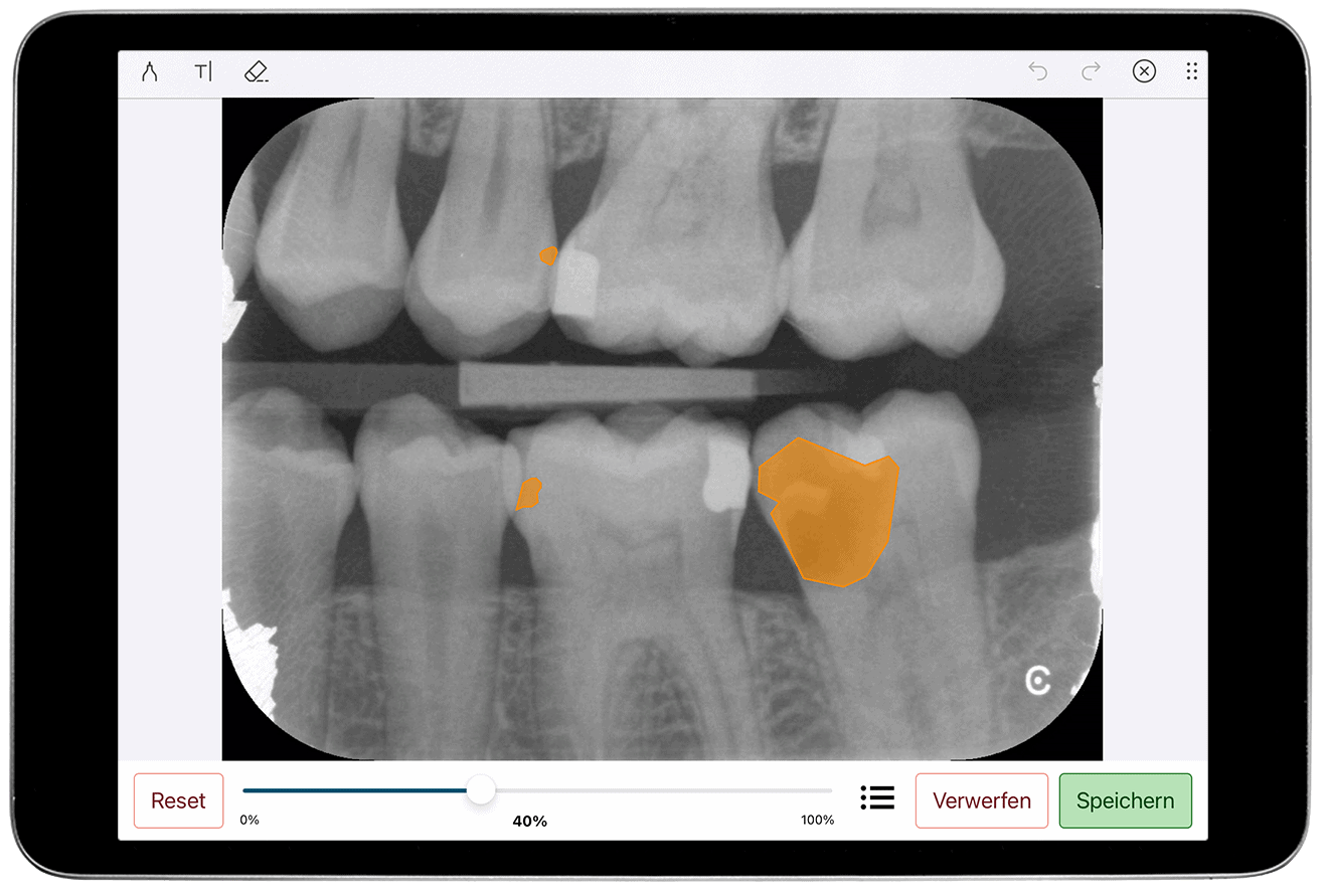 zahnmedizin ki röntgenbildanalyse. Digitale Anamnese und Aufklärung mit der Athena-App.