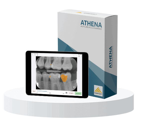 KI Tool für Zahnärzte. Digitale Anamnese und Aufklärung mit der Athena-App.