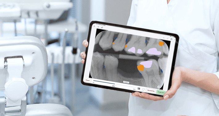 Dampsoft Athena Funktionen KI-Roentgenbildanalyse