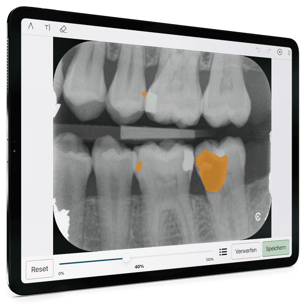 Athena: Diagnose mit dem KI-Add-on