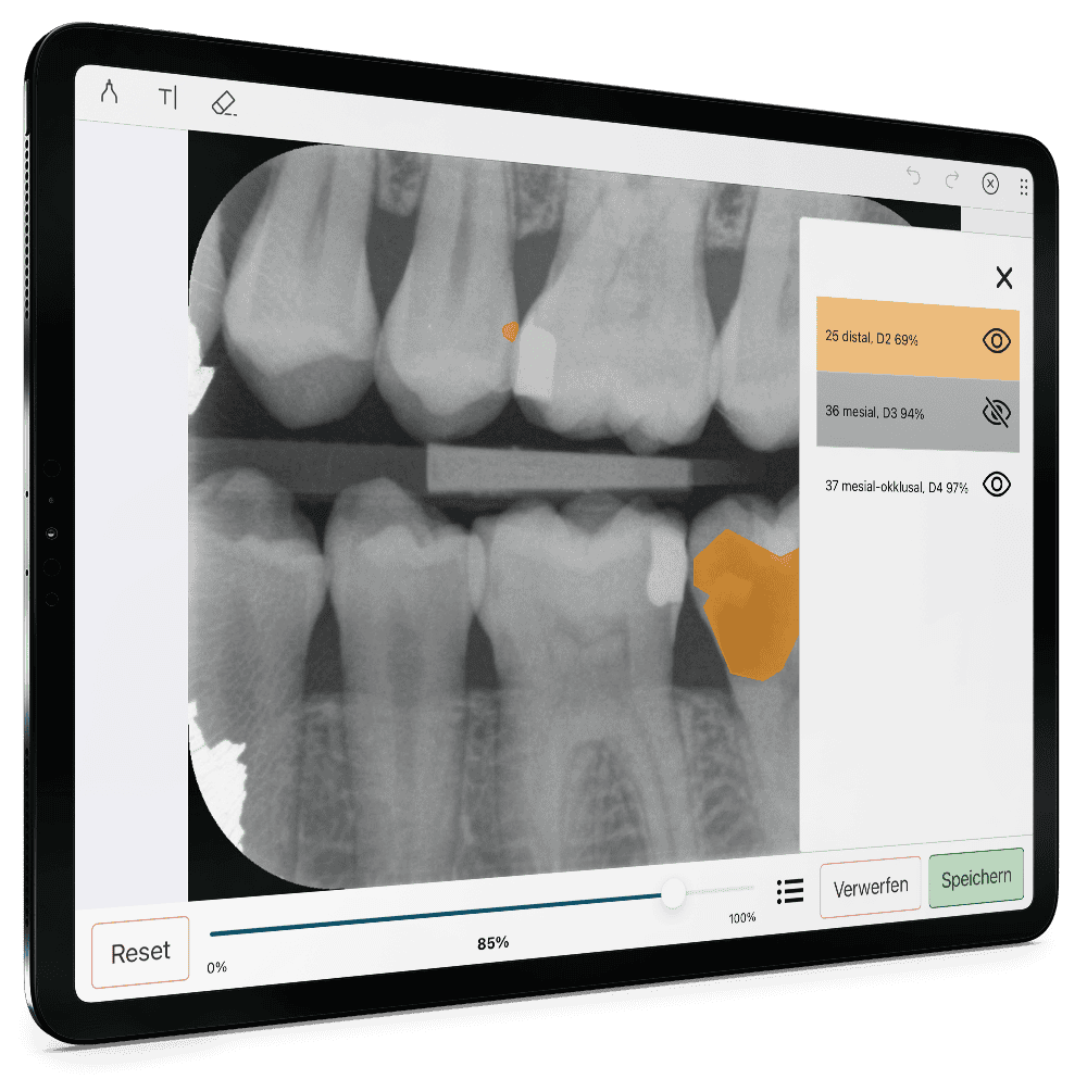 Athena: Diagnose mit dem KI-Add-on