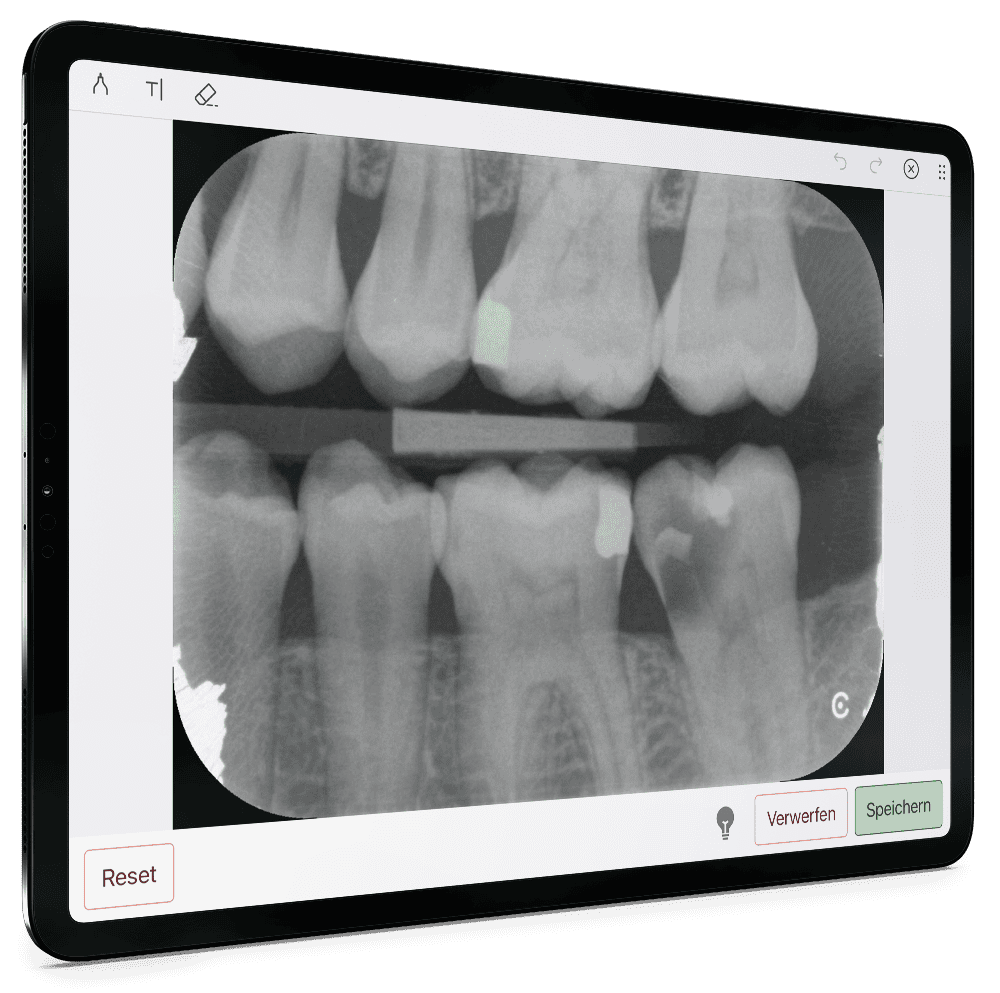 Athena: Diagnose mit dem KI-Add-on