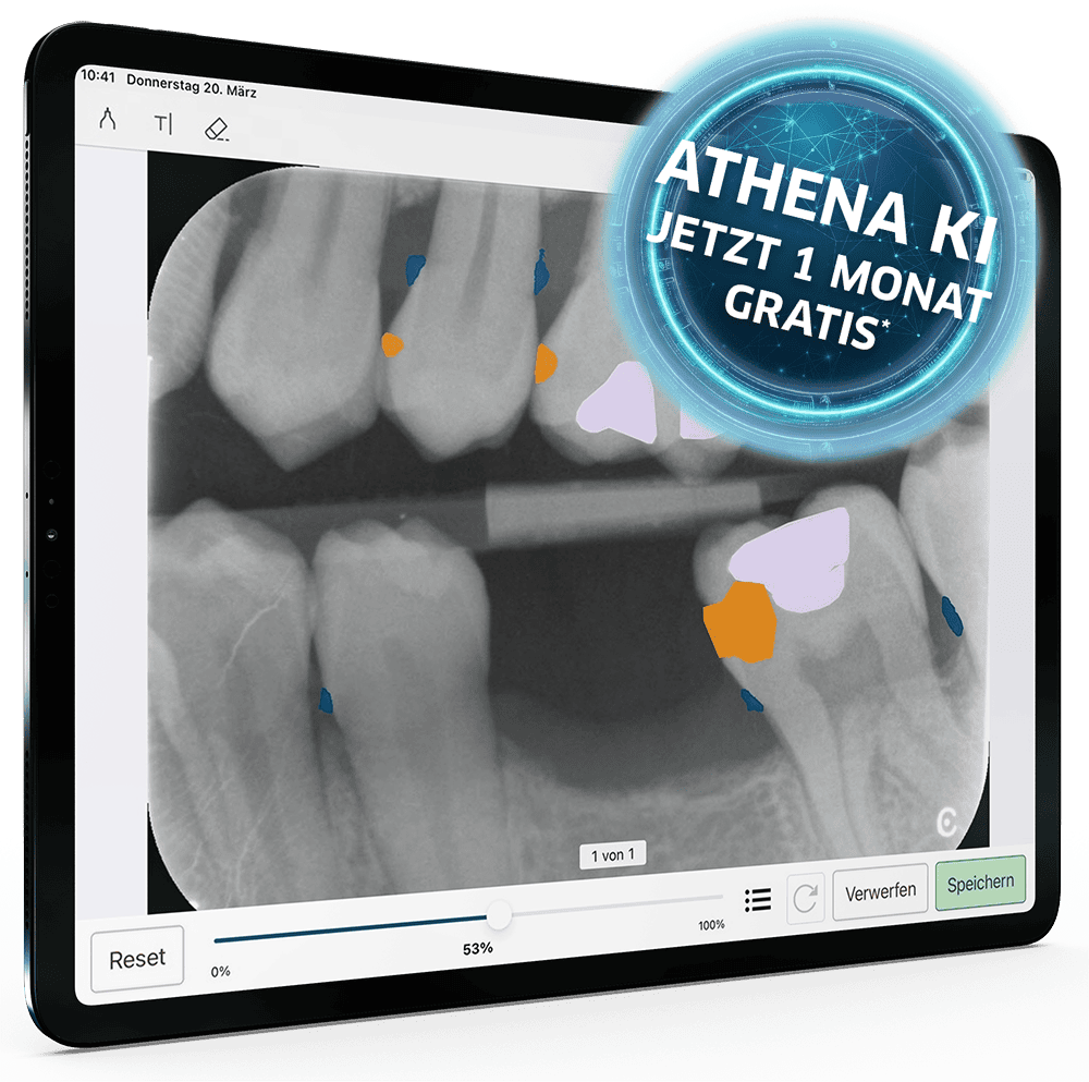 athena-ki-aktion-ipad-ki-v2-bitewing-konkremente-karies