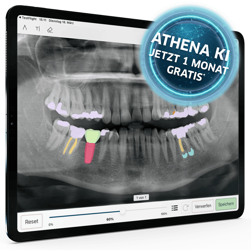 athena-ki-aktion-ipad-ki-v2-opg-auffaelligkeiten-restau1