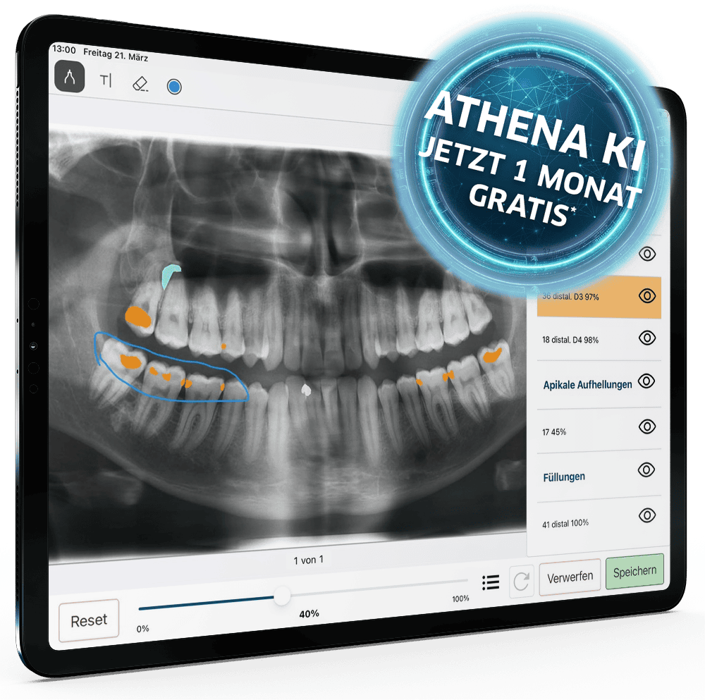 athena-ki-aktion-ipad-ki-v2-opg-auffaelligkeiten-tabelle