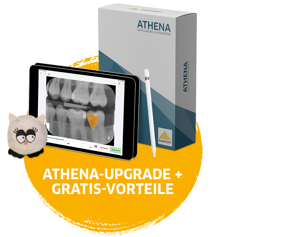 Athena- Aktion Upgrade